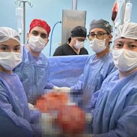 ¡Impresionante! Extirpan un tumor de 14 kilos en una delicada cirugia
