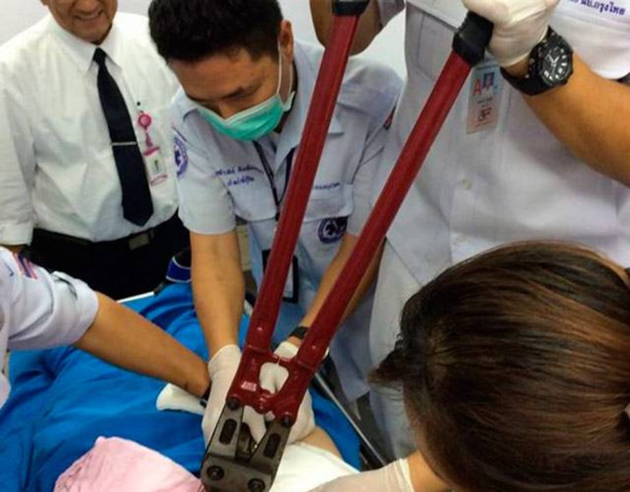 Cuando el anillo de metal queda atascado al "amiguito" los doctores recurren a todo tipo de herramientas. Foto: Cromosomax.com