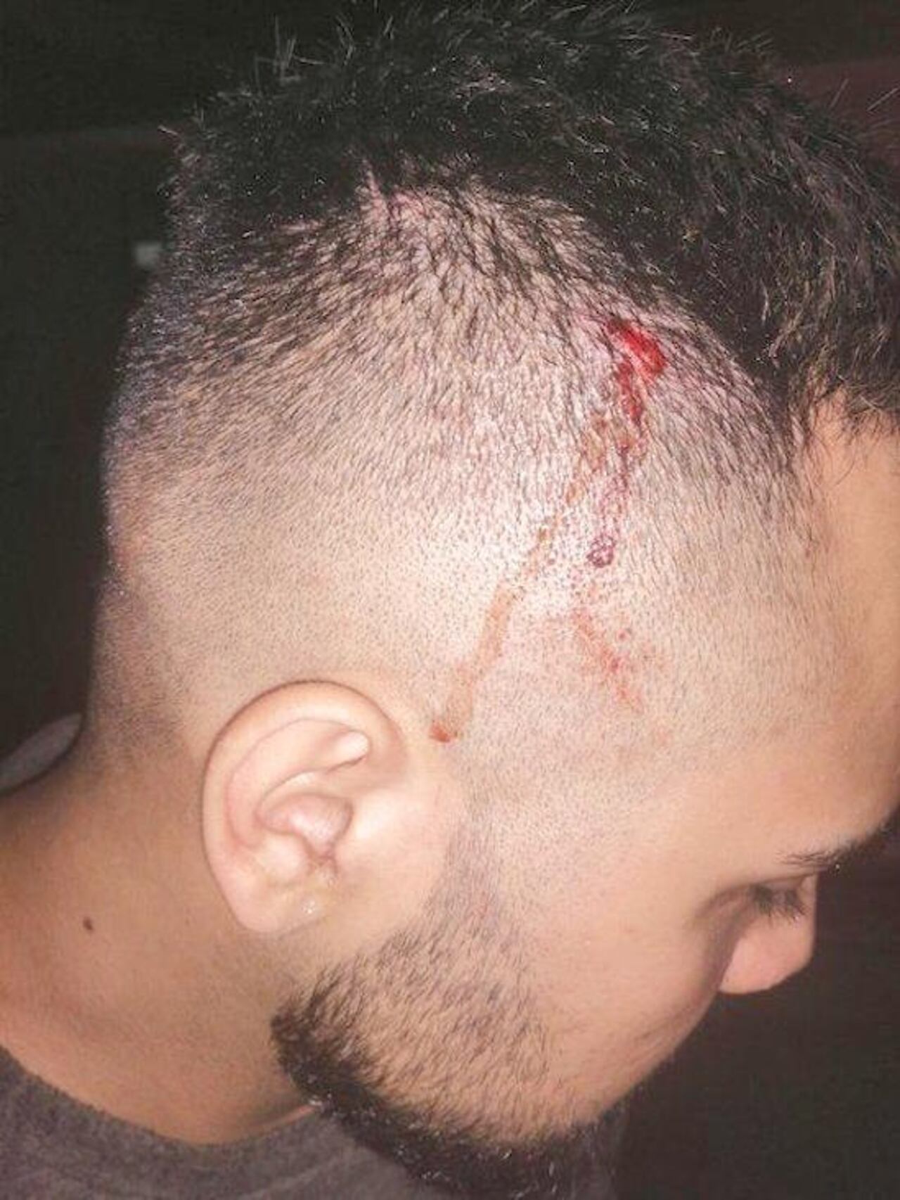 El joven fue herido por agentes linces.
