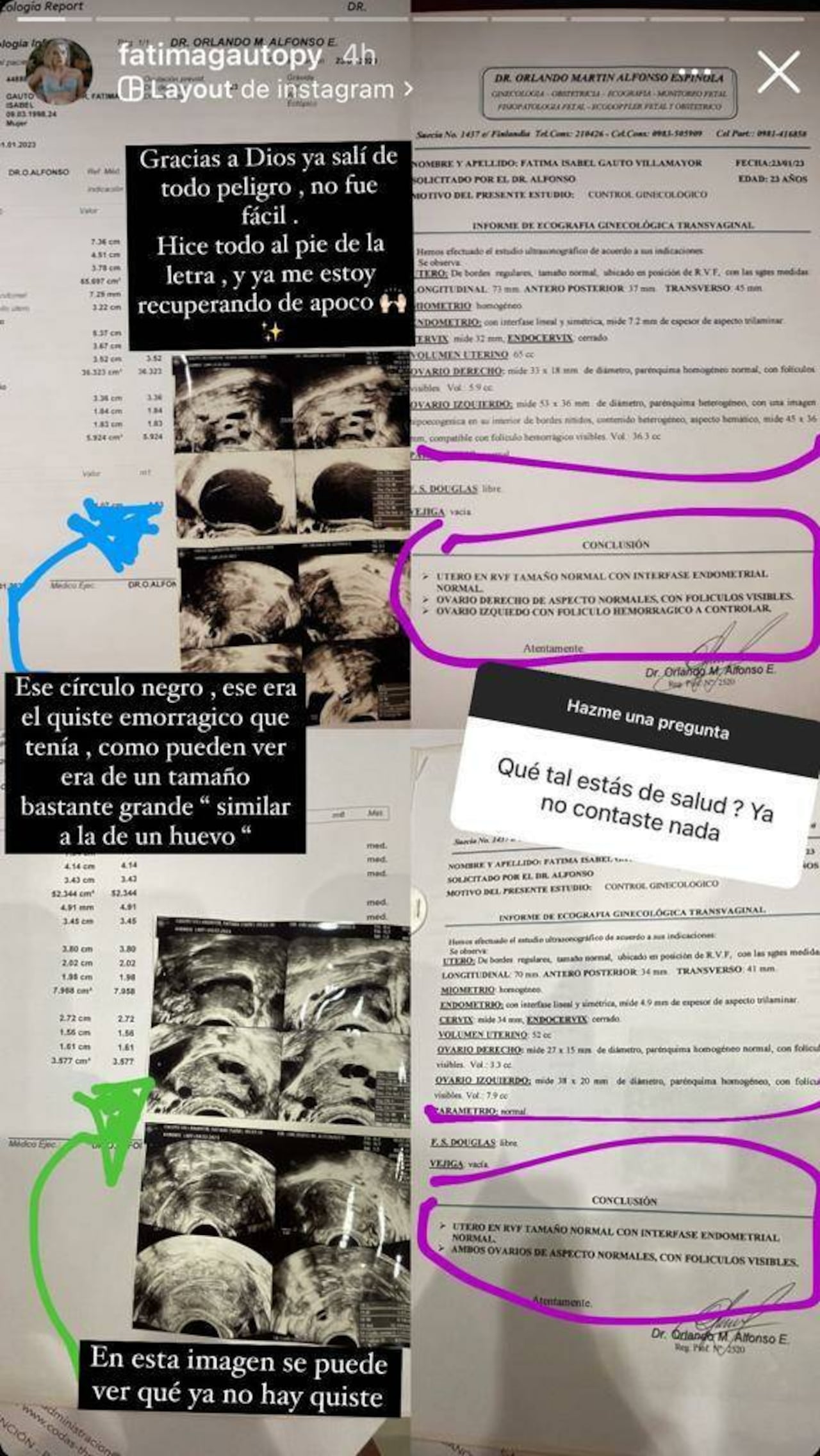 La publicación de Fátima Gauto sobre la enfermedad que le detectaron y sobre cómo está ahora.