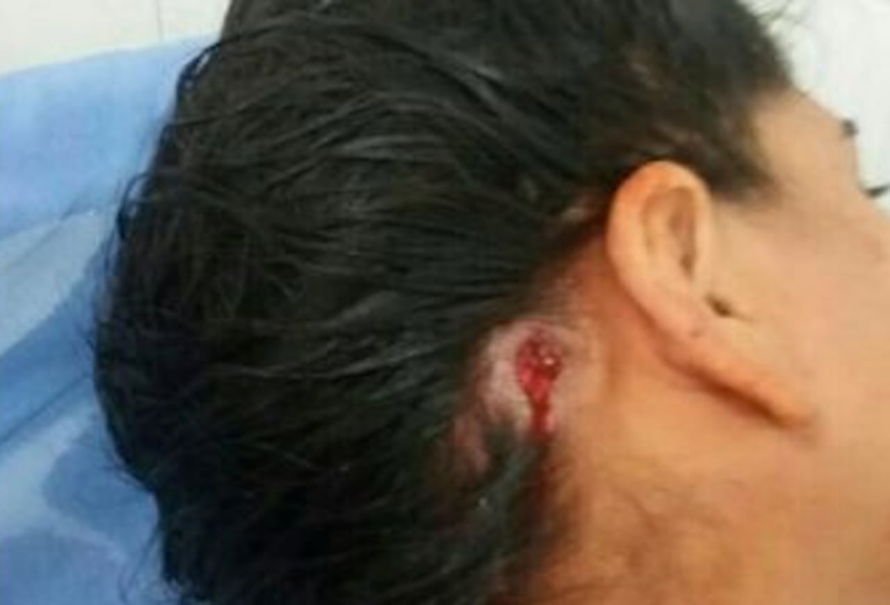 HORRIBLE. La bala quedó en el cráneo de Rosana luego de la intervención médica.