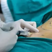 ¿Cuáles son las cirugías preferidas de las paraguayas?