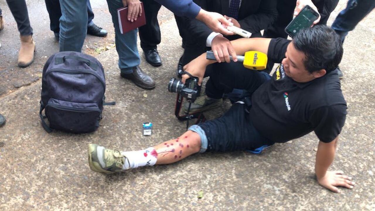 Fernando Riveros, reportero gráfico de nuestro diario quedó herido.