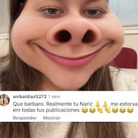 Creadora de contenido cuenta que su nariz siempre fue motivo de bullying
