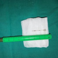 Salvan a bebé de 2 años que tragó un alfiler
