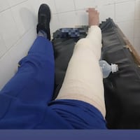 Alumno de 14 años fue agredido por 6 compañeros