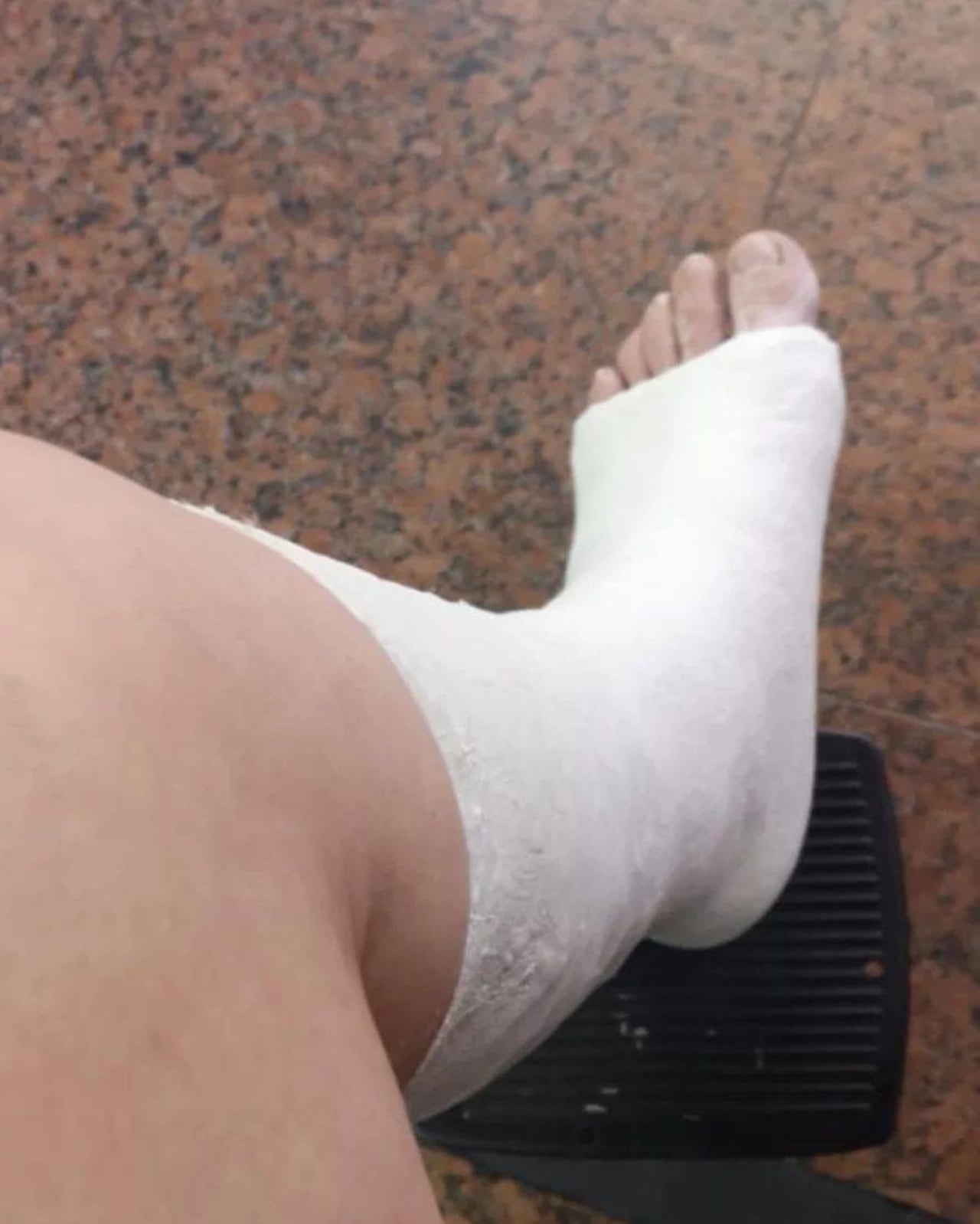 Así quedó Marly Cáceres, con la pierna enyesada. @caceresmarly
