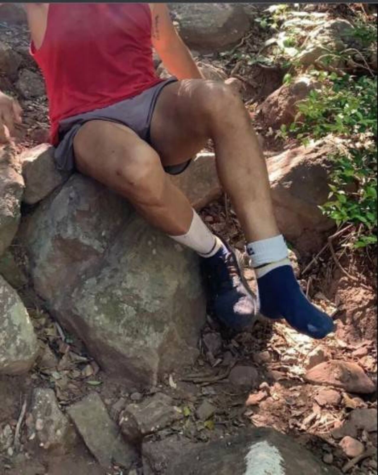 Así quedó la pierna del humorista luego de la caída. (Instagram @mannidelvalle)