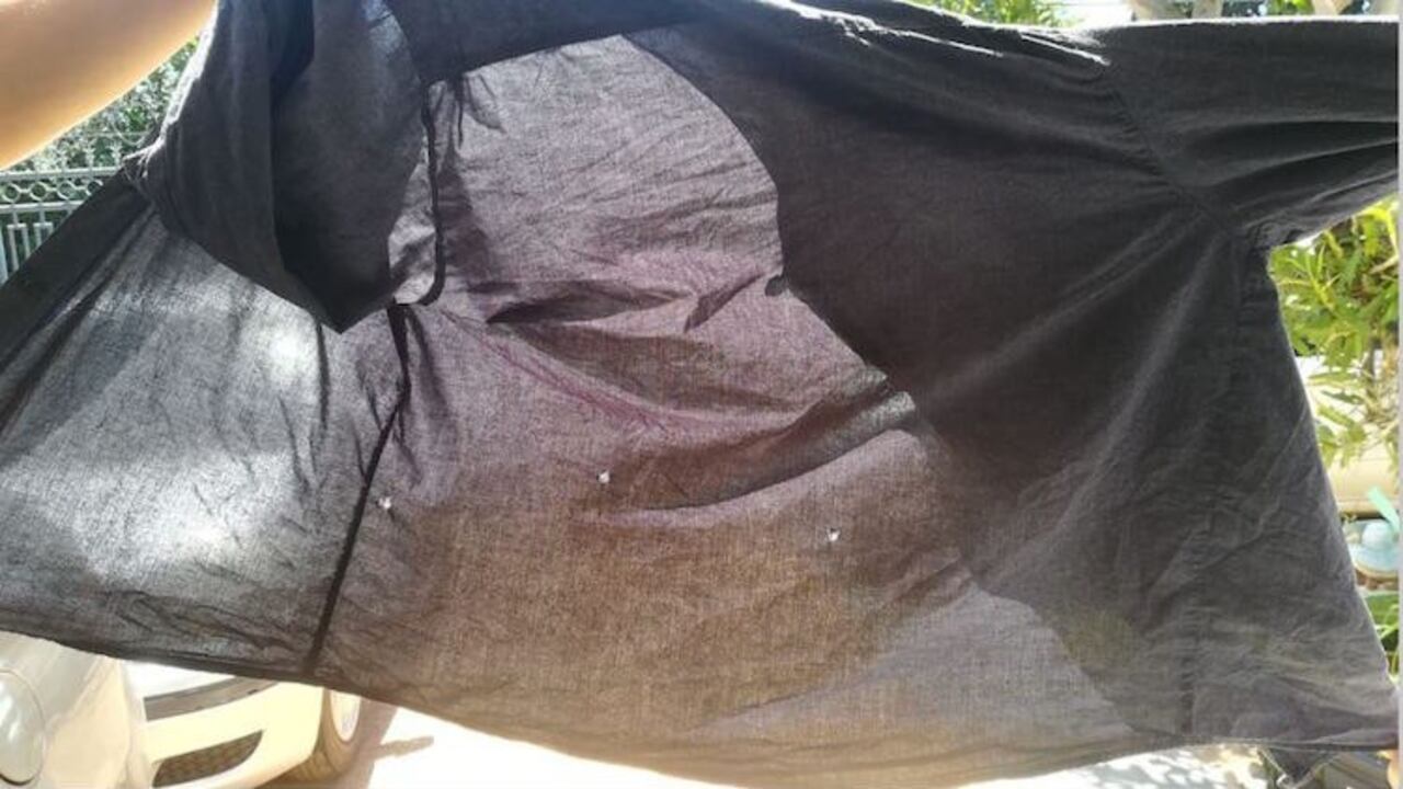 Álvaro terminó con la camisa ensangrentada a un sanatorio, luego de realizar su laburo.