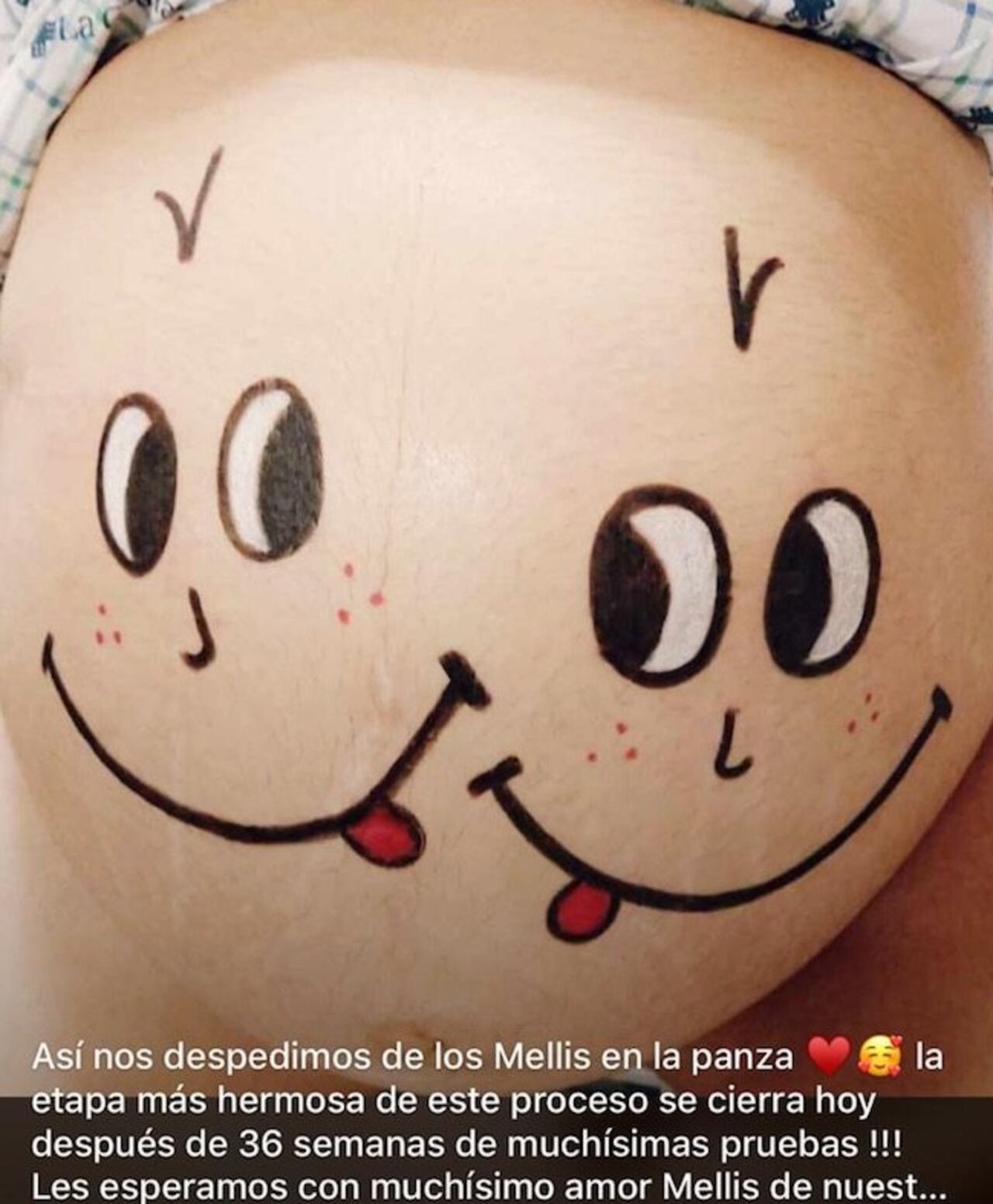 Los mellis en la pancita, a punto de nacer.