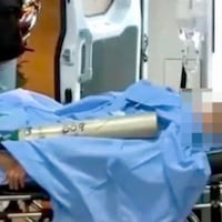 Hugo Javier sigue grave y ahora enfrenta una meningitis