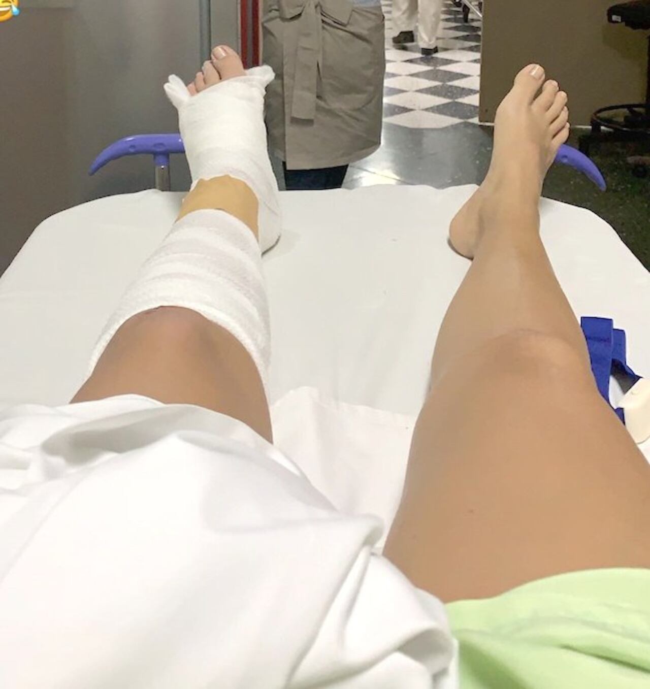 Así terminó la pierna de la modelo que deberá operarse hoy.