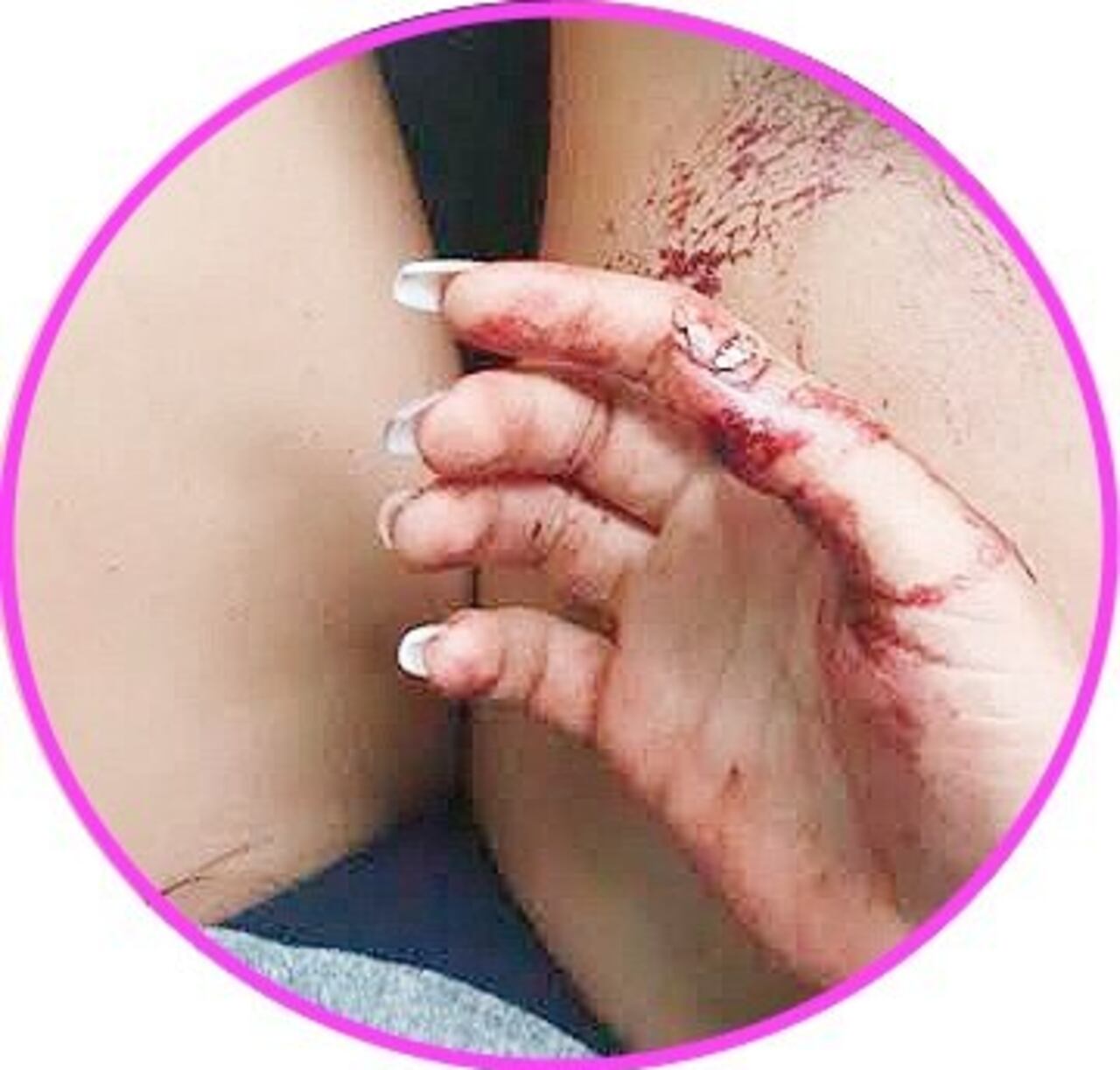 Janet muestra su mano herida.