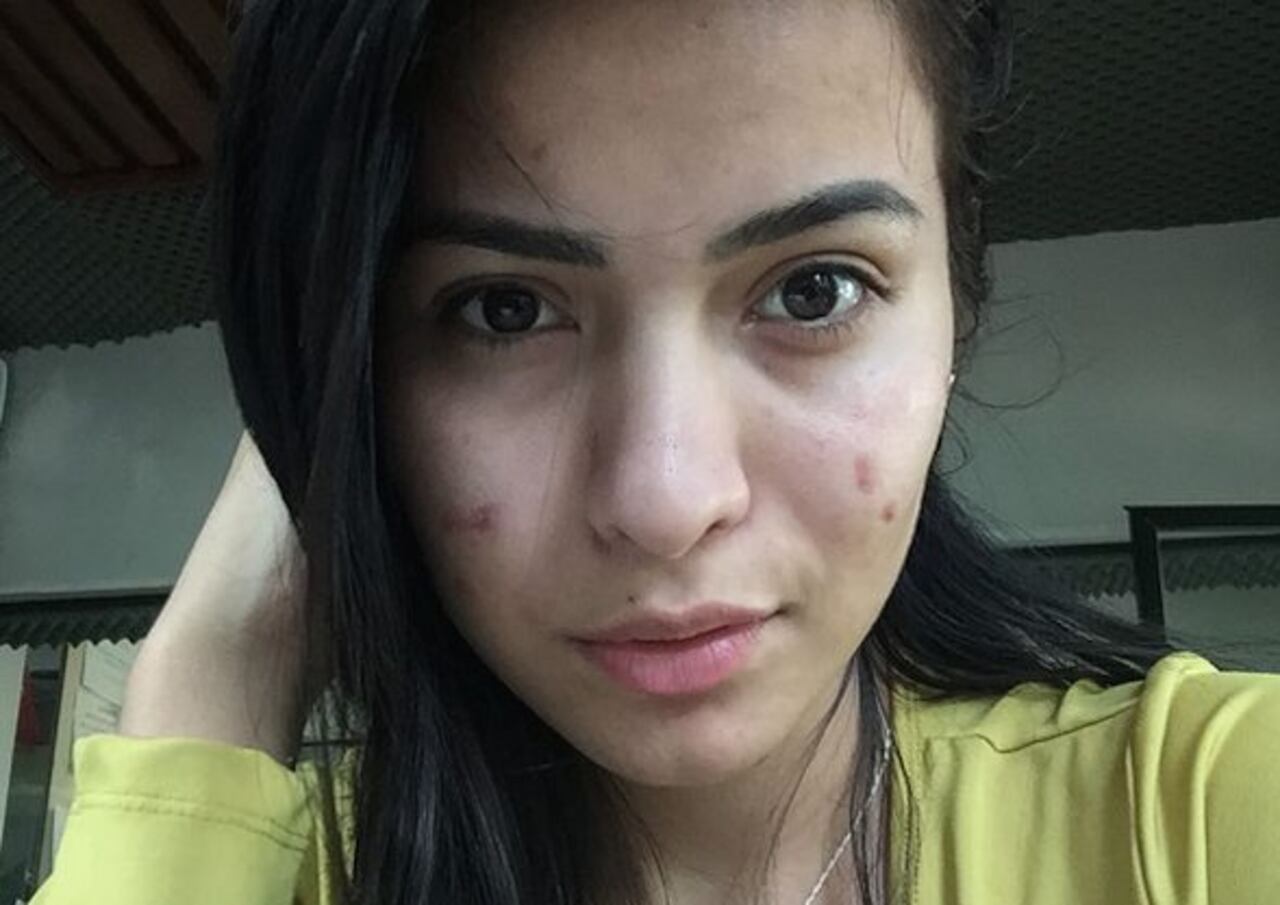 SIN FILTRO. Estas son algunas de las fotografías que la morocha compartió en redes, sin filtro y con sus imperfecciones que hoy día son tratadas.